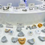 The Art and Science of Modern Dental Prosthetics: A Look Inside the Lab